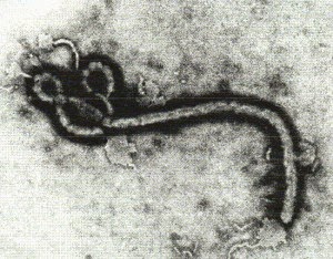 エボラ出血熱